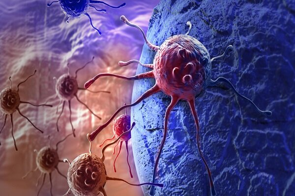 سرمایه‌گذاری برای توسعه درمان سرطان با نانوذرات و لیزر