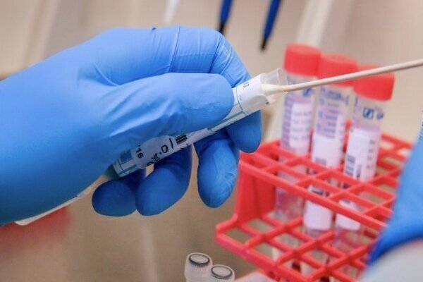 تست PCR قابل‌اعتمادتر است یا نتیجه سی‌تی‌اسکن؟