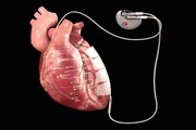 روش‌های زیست‌فناوری برای بهبود سلامت قلب