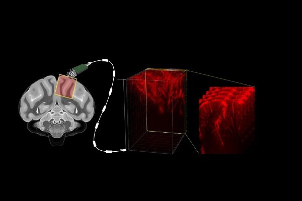 دستگاهی که با امواج سونوگرافی مغز را می‌خواند