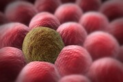 ترکیب دو روش درمانی برای از بین بردن سلول‌های سرطانی