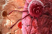 توسعه روش‌های درمانی سرطان با تقلید از نوعی پروتئین خاص