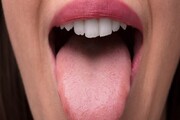 علائم سرطان زبان، گردن و ریه چیست؟