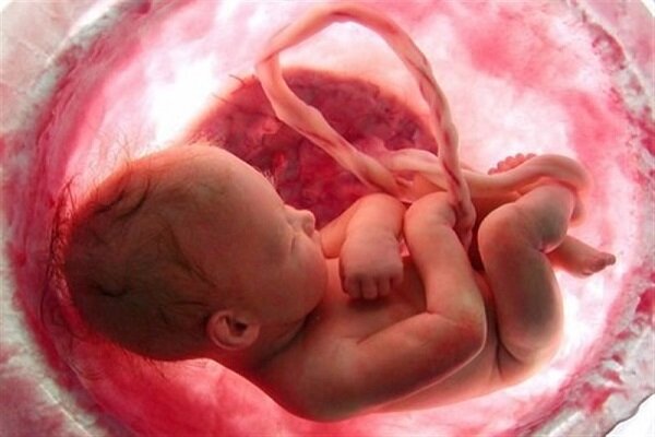 وزارت بهداشت چه برنامه‌ای برای سقط غیرعمد جنین دارد؟