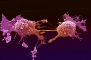 پیشگیری از سرطان‌ها با کمترین هزینه