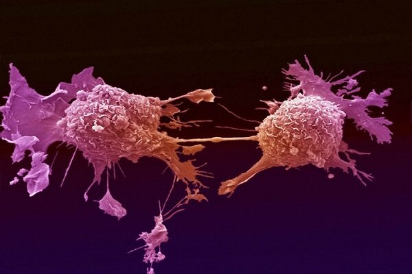 نقش موثر ویتامین D در پیشگیری از سرطان روده