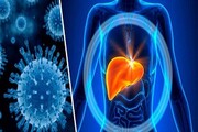 آمار مبتلایان به هپاتیت C در ایران