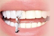 سفید کردن دندان با ۷ روش خانگی