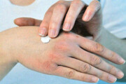 چگونگی مراقبت از پوست دست و صورت در محل کار