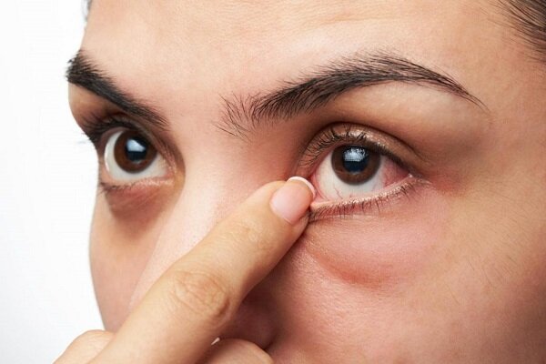 علامت چشمان فردی که دچار دیابت شده است

