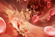 پیش بینی احتمال ابتلا به دیابت و سرطان از طریق پروتئین خون