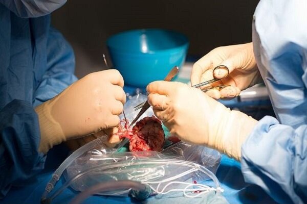 جراحان کلیه خوک را به یک مرد مرگ مغزی پیوند زدند