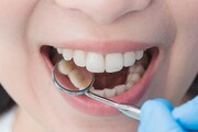 بیماری‌هایی که با معاینه دندان مشخص می‌شوند