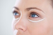 استفاده از کرم دور چشم برای کل صورت؛ صحیح یا غلط؟