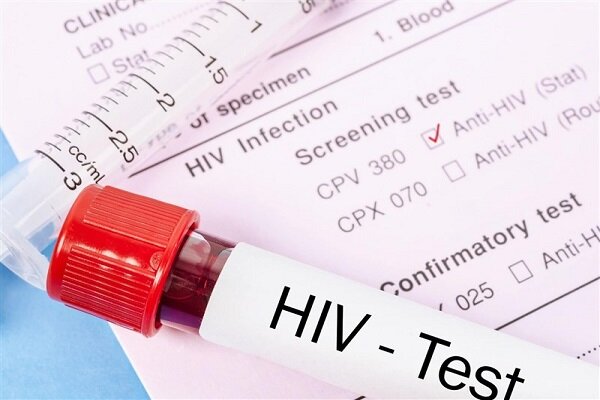 ویروس HIV افراد مبتلا را زودتر پیر می‌کند