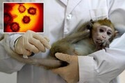 افرادی که در معرض خطر ابتلا به آبله میمون قرار دارند