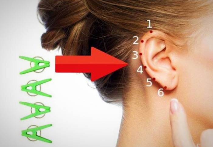 نقاط ویژه روی گوش برای تسکین درد