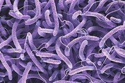 ۳۷ نفر در کشور به وبا مبتلا شدند