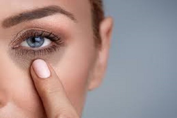 درمان خانگی رفع سیاهی زیر چشم چگونه است؟ /چگونه از سیاه شدن زیر چشم جلوگیری کنیم؟