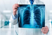 ۲۰ راز که باید درباره اشعه ایکس بدانید