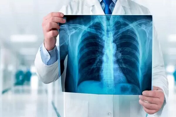 ۲۰ راز که باید درباره اشعه ایکس بدانید