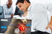 دیسک کمر چیست و چه موقع خطرناک است؟