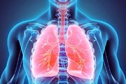 آلاینده‌های هوایی چگونه باعث سرطان ریه می‌شوند؟