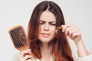 ۲۰ راهکار برای جلوگیری از ریزش مو