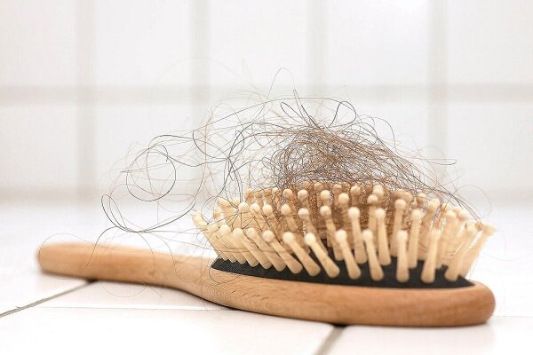 موثرترین روش درمان ریزش مو که از آن بی‌خبرید
