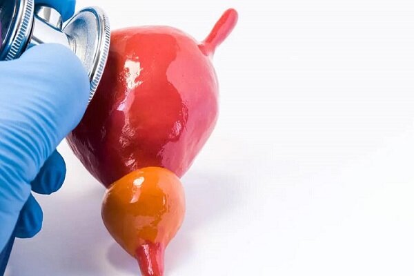 سنگ مثانه چرا و چگونه به وجود می‌آید؟