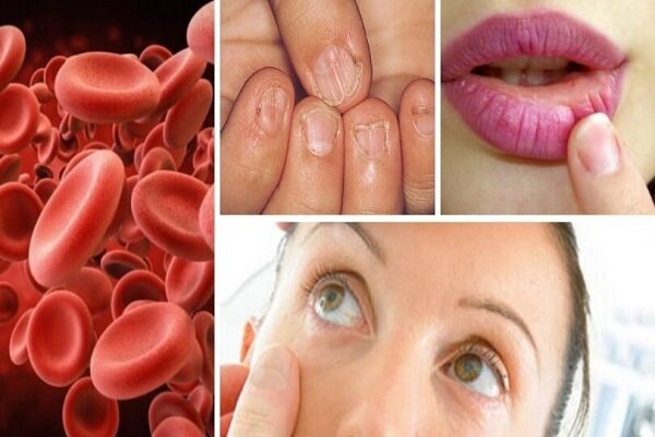 عفونت خون چیست و چگونه درمان می‌شود؟