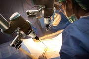 ساخت حسگر جدیدی که روبات‌های نرم جراح را دقیق‌تر می‌کند
