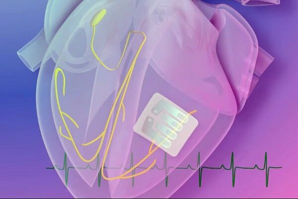 خالکوبی الکترونیک ریتم ضربان قلب را کنترل می‌کند