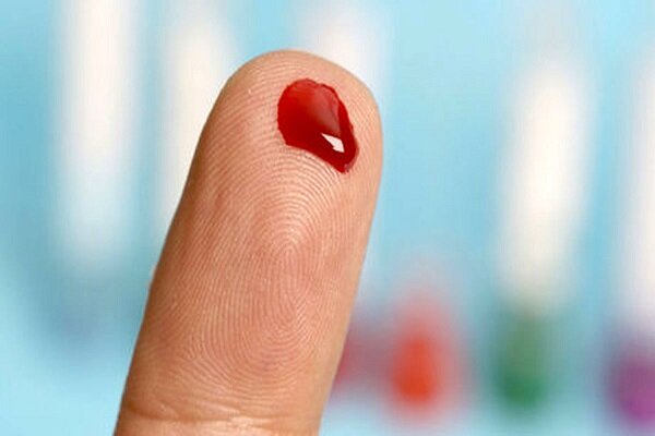 توقف ایجاد لخته‌های خون در بدن بدون خطر خون‌ریزی