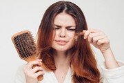 راهکارهای طب سنتی برای جلوگیری از ریزش مو