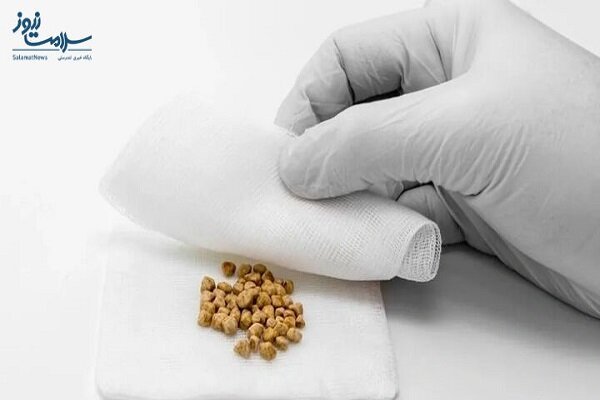 ۸ درمان خانگی برای از بین بردن سنگ کیسه صفرا