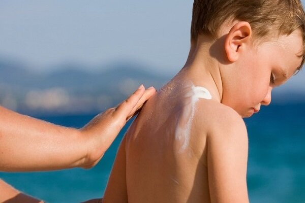 درمان فوری آفتاب سوختگی با این روش‌ها