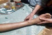 نحوه کمک‌های اولیه در مواجهه با شکستگی‌های استخوان