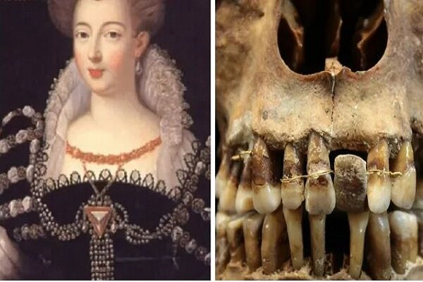 کشف راز زن اشراف‌زاده مومیایی برای حفظ دندان‌هایش