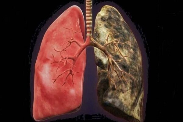روشی موثر برای ترمیم ریه‌های  افراد سیگاری 