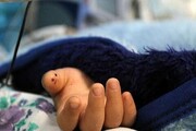 درمان  رایگان کودکان زیر ۷ سال در بیمارستان‌های دولتی