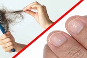 علائم کمبود ۷ ماده مهم غذایی در بدن