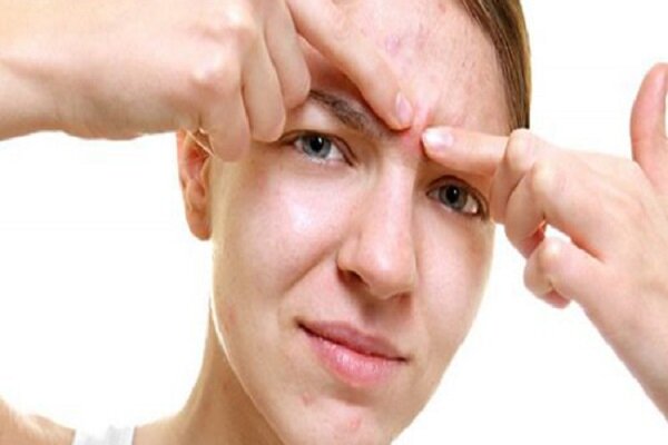 دلایل شایع خارش مداوم پیشانی دلایل شایع خارش مداوم پیشانی