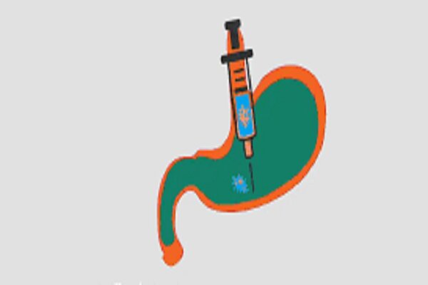 آشنایی با عوارض بوتاکس معده