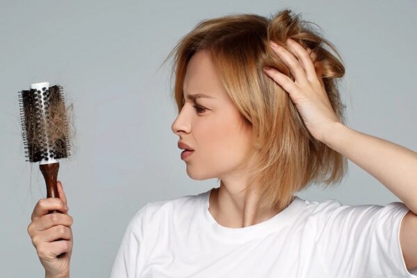 جلوگیری از ریزش مو با روشهای سریع و آسان جلوگیری از ریزش مو با روشهای سریع و آسان
