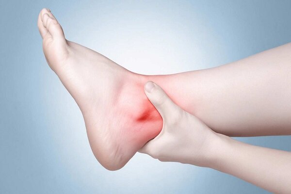 راه‌های تسکین دادن ورم مچ پا