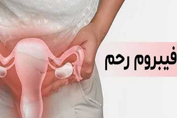 چرا فیبروم به وجود می آید؟