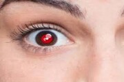 قرمزی مردمک چشم در عکس‌ها از وجود بیماری خبر می‌دهد؟