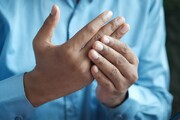 دلیل اصلی سفت شدن مفاصل انگشتان چیست؟