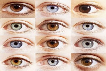 اطلاعاتی درباره تغییر رنگ چشم و کاشت نگین